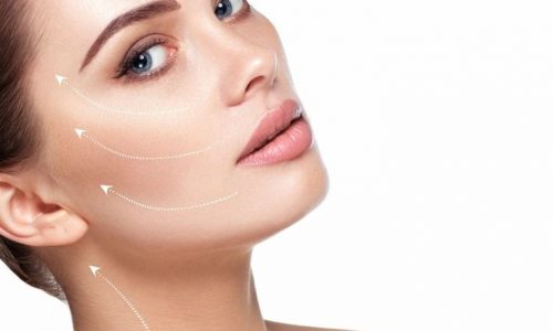 מתיחת פנים באמצעות חוטים