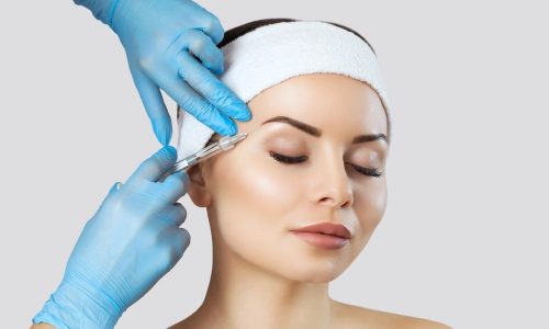 מילוי קמטים בחומצה היאלרונית